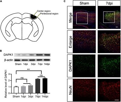 MicroRNA-124/Death-Associated Protein Kinase 1 Signaling Regulates Neuronal Apoptosis in Traumatic Brain Injury via Phosphorylating NR2B